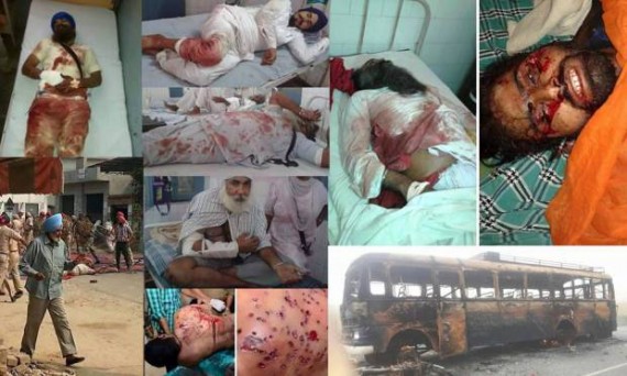 Pictures of dead and injured Sikhs from Oct. 14 violence